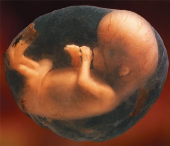 a fetus