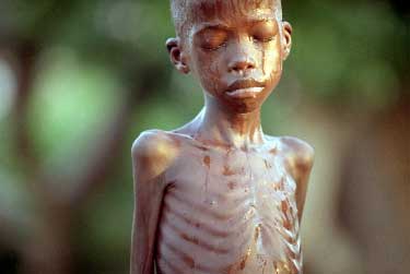 ap_famine_sudan_photog-Brennan_Linsley