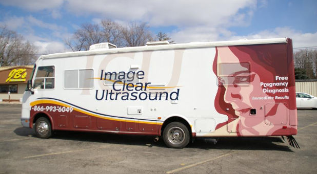 TLC mobile ultrasound