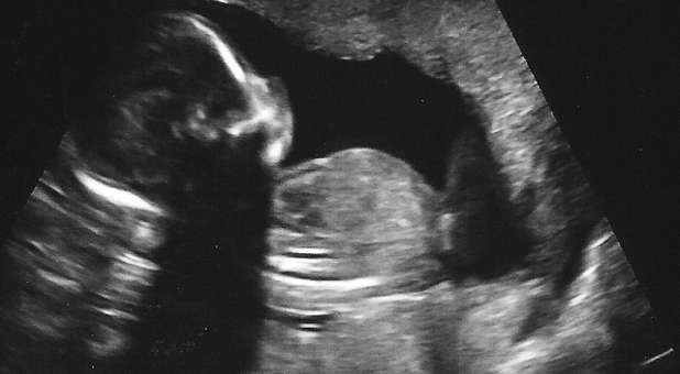 Ultrasound baby unborn baby life