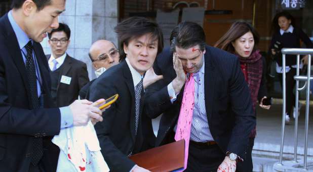 The U.S. ambassador to South Korea Mark Lippert (R) leaves after he was slashed in the face by an unidentified assailant at a public forum.