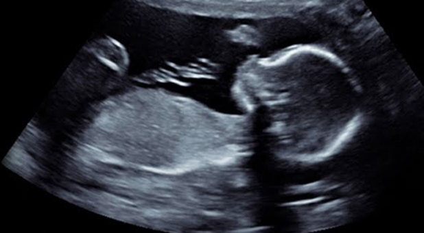 Public domain image of ultrasound