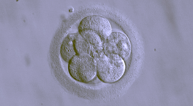 Public Domain Image of Human Embryo