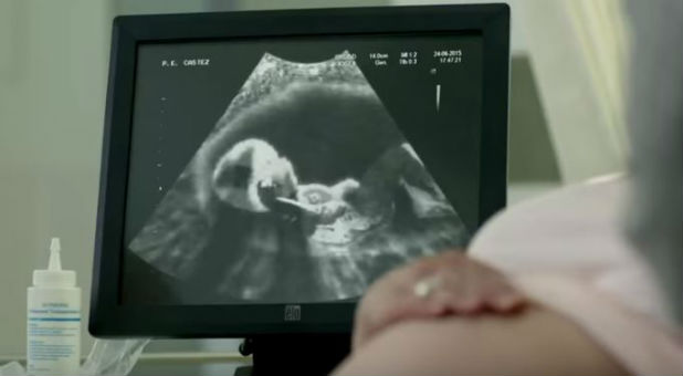 The ultrasound of a baby excited about Doritos.