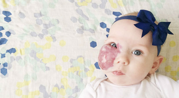 Katie Crenshaw asks people to stop praying Charlie's (pictured) hemangioma goes away.