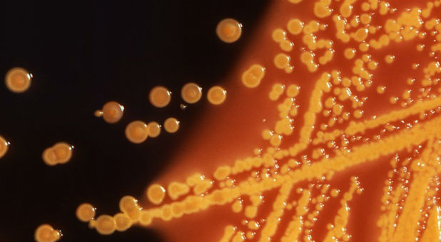 Colonies of E. coli bacteria grown on a Hektoen enteric (HE) agar plate are seen in a microscopic image.