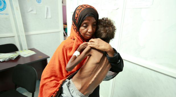 A woman cares for her malnourished son.